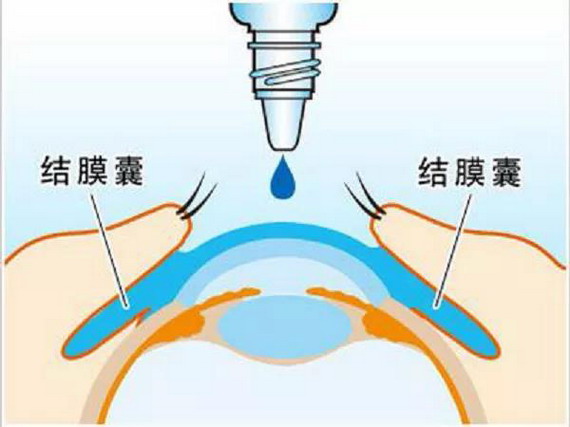 微信图片_20210309141746_缩小大小.jpg 微信图片_20210309141746_缩小大小.jpg