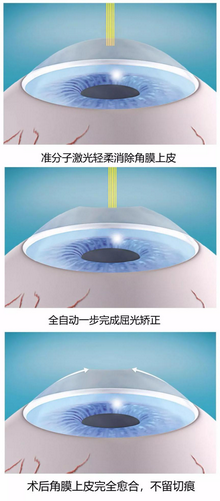 图片3_缩小大小.png 图片3_缩小大小.png
